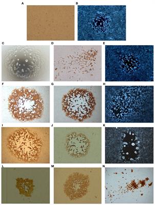 Whole genome sequencing of recombinant viruses obtained from co-infection and superinfection of Vero cells with modified vaccinia virus ankara vectored influenza vaccine and a naturally occurring cowpox virus